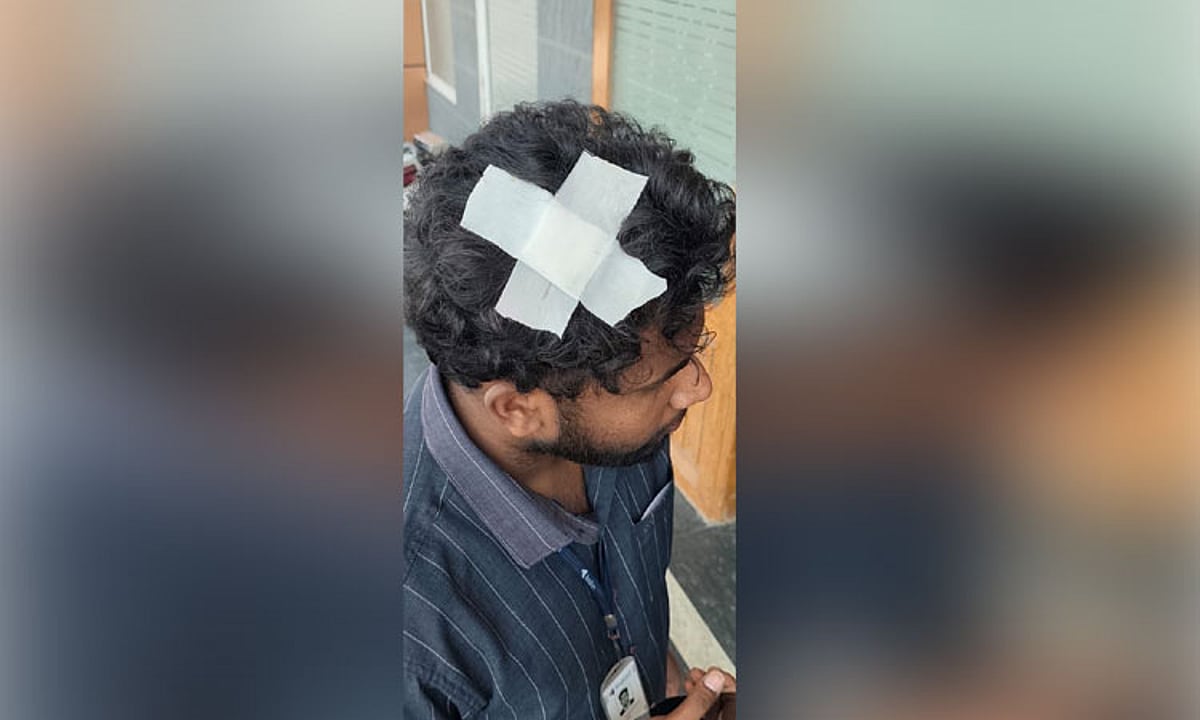 சென்னையில் மின்சார ரெயில் மீது கல்வீச்சு: பயணிக்கு காயம்