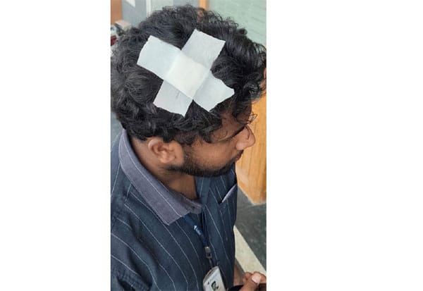 சென்னையில் மின்சார ரயில் மீது கல்வீச்சு: பயணி காயம்